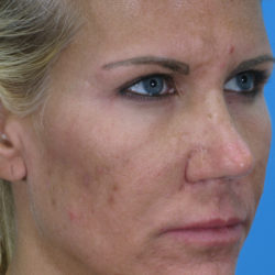 loamquarterbedit-jpg