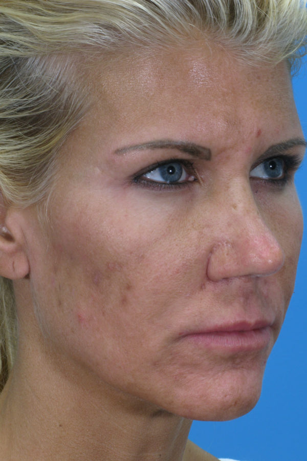 loamquarterbedit-jpg