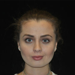 motykie-eyebrow-after-watermark-1-jpg