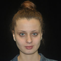 motykie-eyebrow-before-watermark-1-jpg