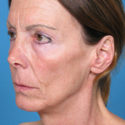 penequarterbedit-1-jpg