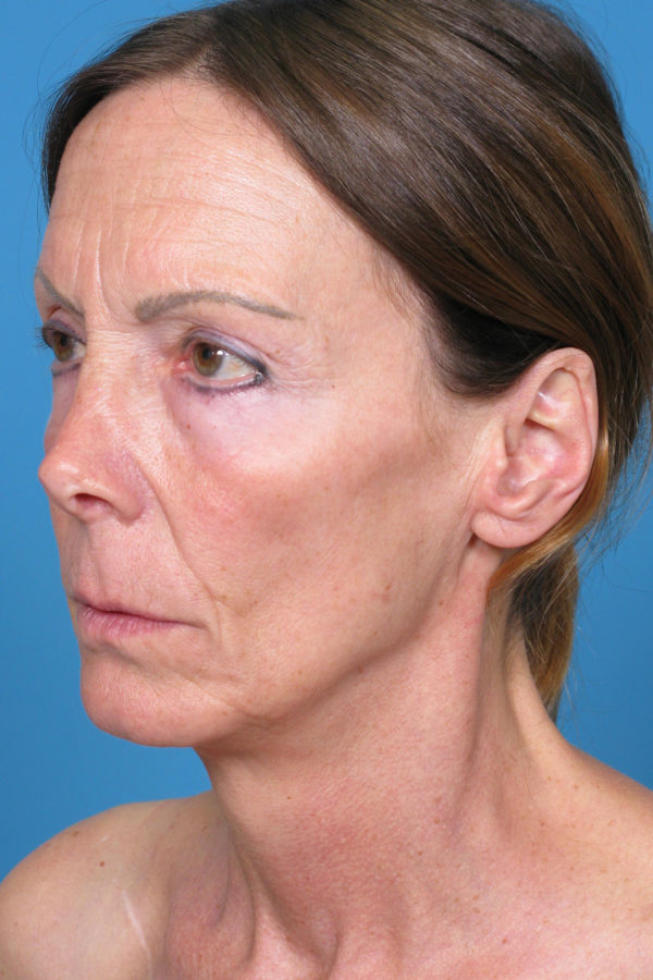 penequarterbedit-jpg