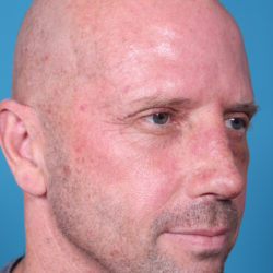 rb-afterquater-jpeg-2-jpg