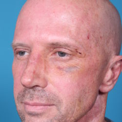 rb-afterquater-jpeg-jpg