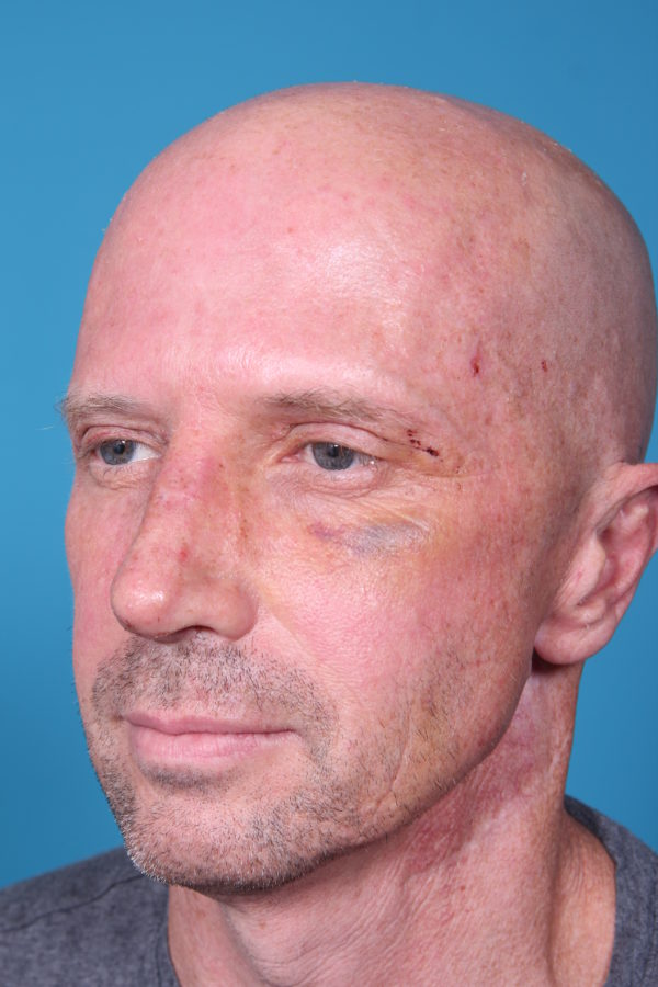 rb-afterquater-jpeg-jpg