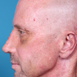 rb-afterright-jpeg-jpg