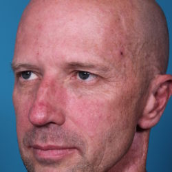 rb-beforequater-jpeg-2-jpg