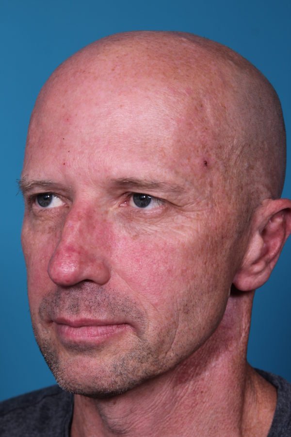 rb-beforequater-jpeg-2-jpg