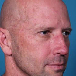 rb-beforequater-jpeg-jpg