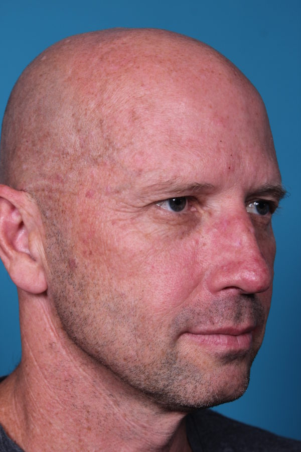 rb-beforequater-jpeg-jpg