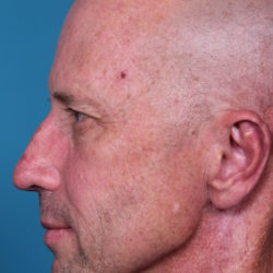 rb-beforeright-jpeg-jpg