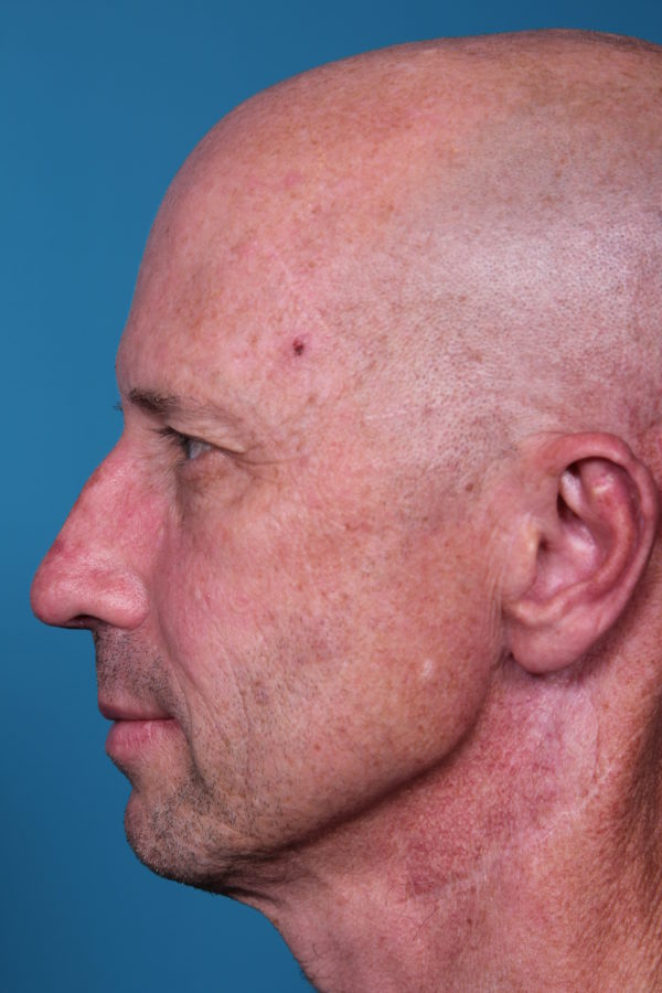 rb-beforeright-jpeg-jpg