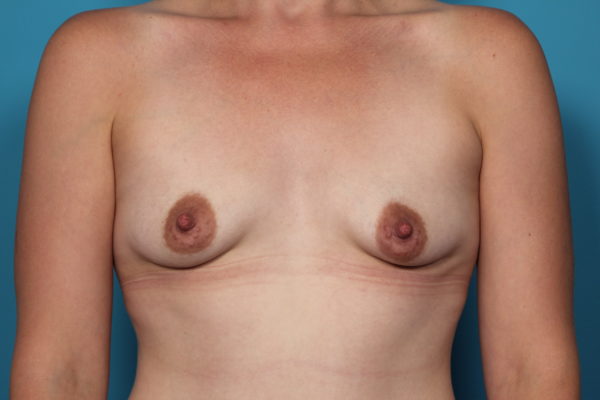 sg-beforefront-jpeg-jpg