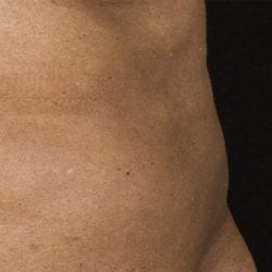 sculpture-case-1-after-jpg