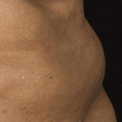 sculpture-case-1-before-jpg