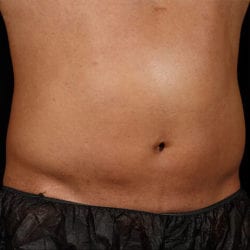 sculpture-case-10-after-jpg