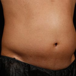 sculpture-case-10-before-jpg