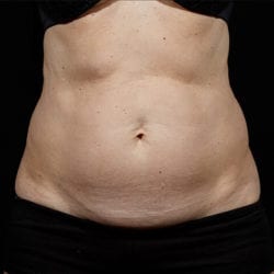 sculpture-case-11-after-jpg