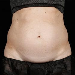 sculpture-case-11-before-jpg