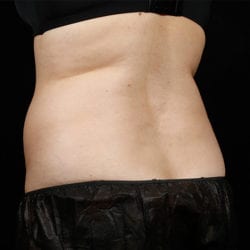 sculpture-case-12-after-jpg