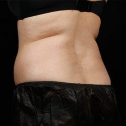 sculpture-case-12-before-jpg