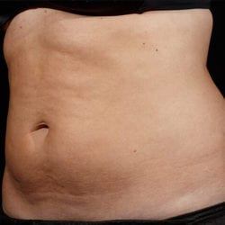 sculpture-case-14-after-jpg