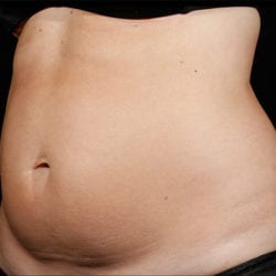 sculpture-case-14-before-jpg