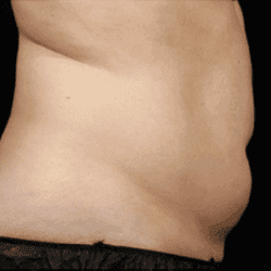 sculpture-case-15-after-png