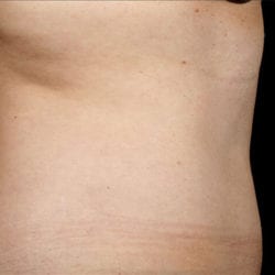 sculpture-case-16-after-jpg