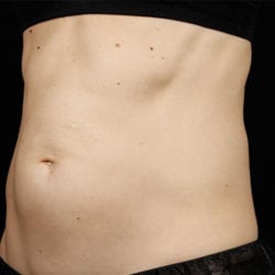 sculpture-case-17-before-jpg