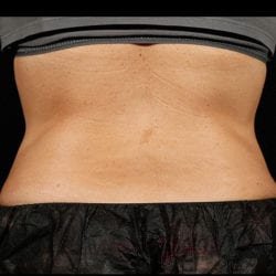 sculpture-case-18-after-jpg