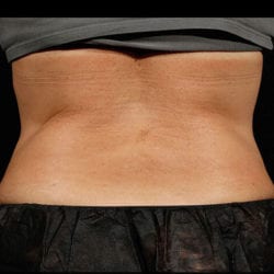 sculpture-case-18-before-jpg