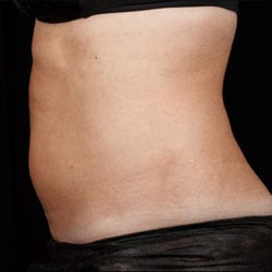 sculpture-case-19-after-jpg