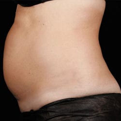 sculpture-case-19-before-jpg