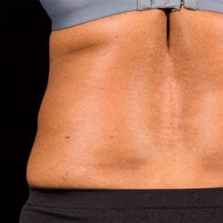 sculpture-case-2-after-jpg