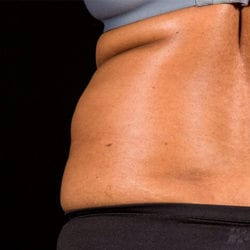 sculpture-case-2-before-jpg