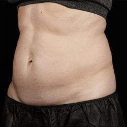 sculpture-case-20-after-jpg