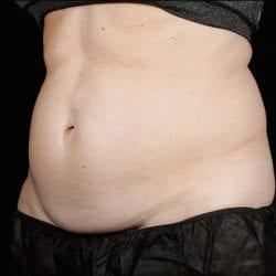 sculpture-case-20-before-jpg