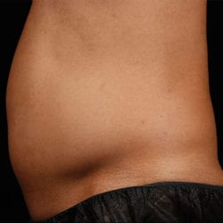 sculpture-case-21-before-jpg