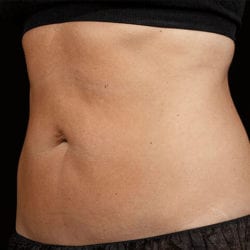 sculpture-case-22-after-jpg