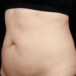 sculpture-case-22-before-jpg