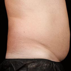 sculpture-case-23-before-jpg