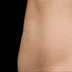 sculpture-case-3-before-jpg