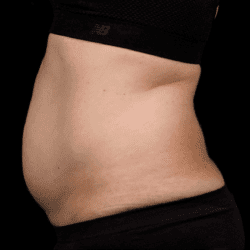 sculpture-case-4-before-png