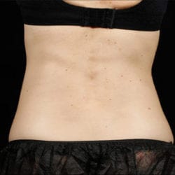 sculpture-case-5-after