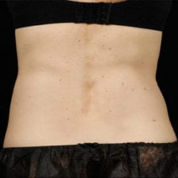 sculpture-case-5-before