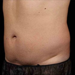 sculpture-case-6-after-jpg