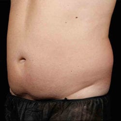 sculpture-case-6-before-jpg