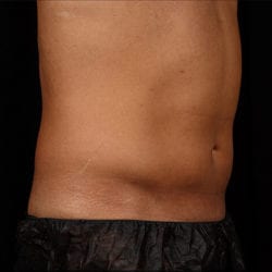 sculpture-case-7-after-jpg