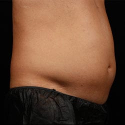 sculpture-case-7-before-jpg